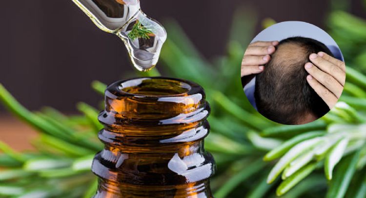 Alopecia: Así puedes hacer aceite de romero para usarlo en tu cabello y hacerlo crecer rápidamente