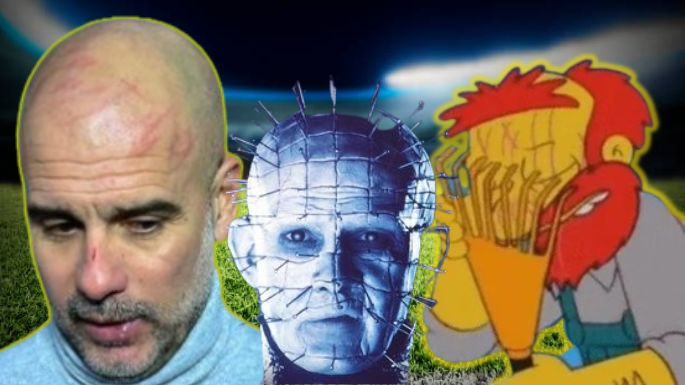 Estallaron los memes: Pep Guardiola apareció con arañazos en el rostro y explicó el insólito motivo