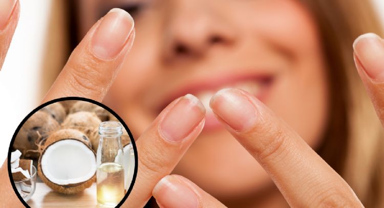 Adiós para siempre a las uñas débiles: la técnica definitiva con aceite de coco