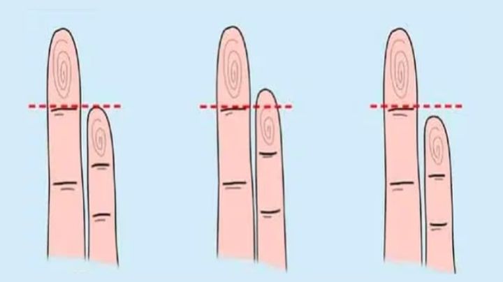 Test de Personalidad: dime cómo se ve tu meñique y te diré cómo eres en el amor