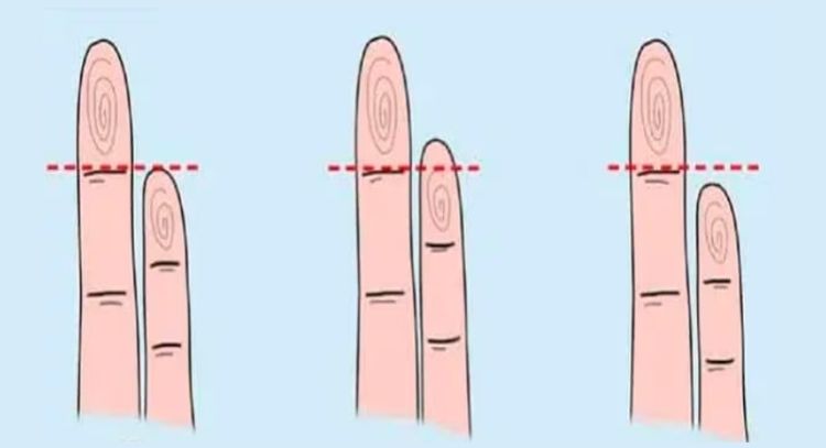 Test de Personalidad: dime cómo se ve tu meñique y te diré cómo eres en el amor