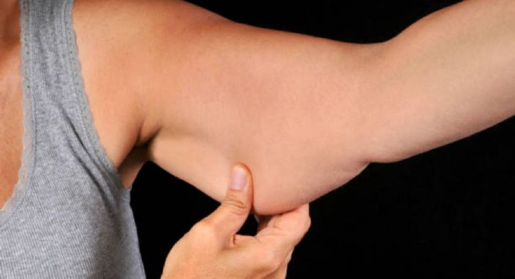 Dile adiós a las 'alas de murciélago' con una crema casera con solo 3 ingredientes