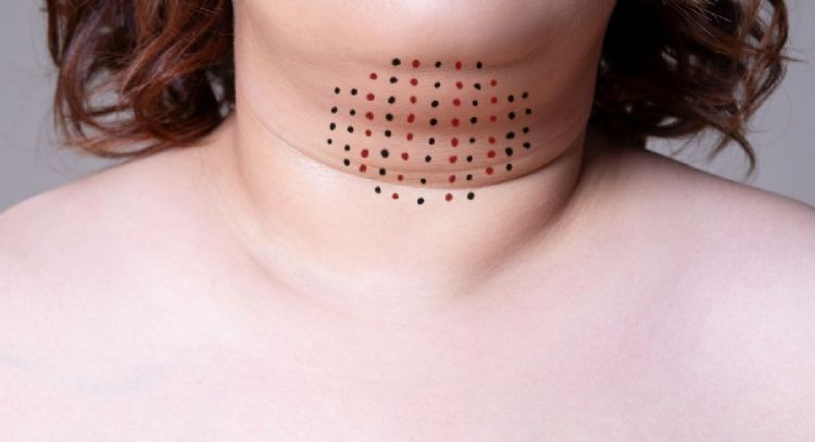 Dile adiós a la papada con estos 5 métodos naturales que puedes hacer en casa