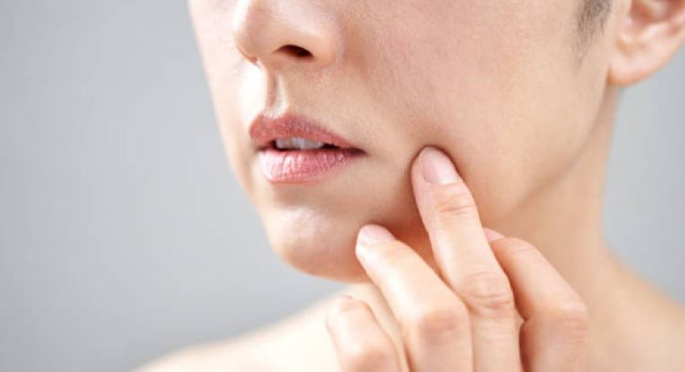 Cómo utilizar el yogurt para eliminar las arrugas de la boca y verte más joven en menos de 1 semana