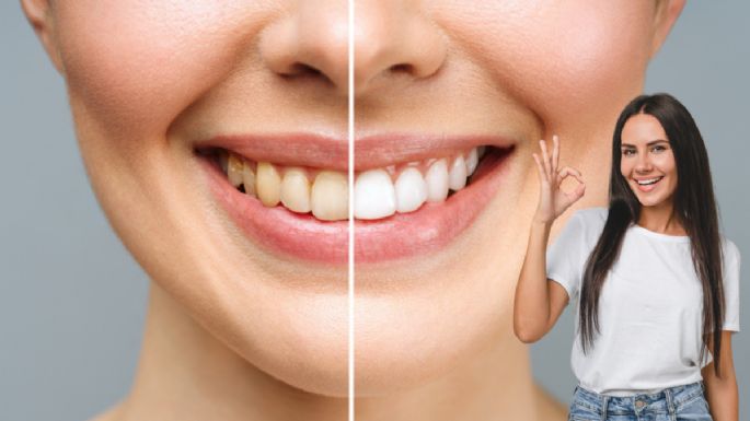 Dile adiós a los dientes amarillos con solo 1 ingrediente de cocina