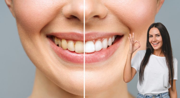 Dile adiós a los dientes amarillos con solo 1 ingrediente de cocina