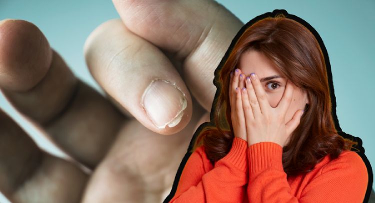Uñas fuertes y resistentes: el secreto natural que cambiará tu rutina