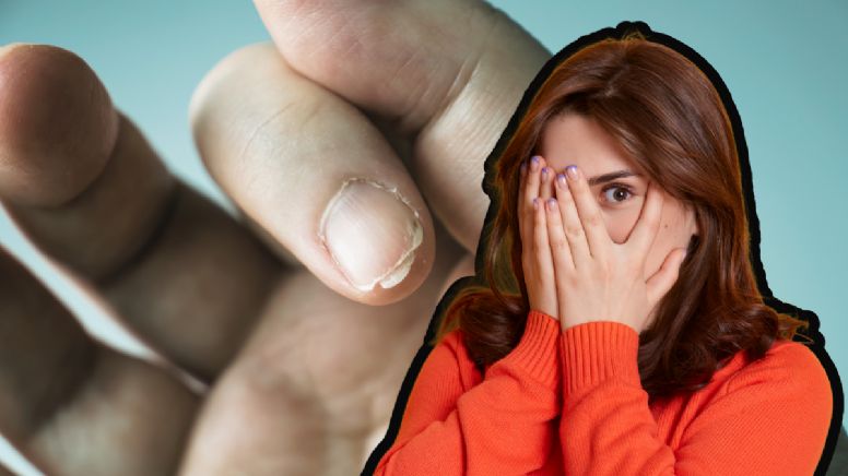 Uñas fuertes y resistentes: el secreto natural que cambiará tu rutina