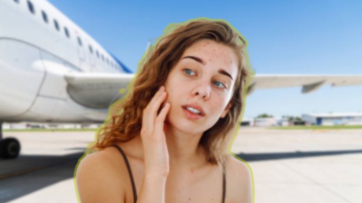Se confirmó el daño en la piel que producen los viajes en avión y los cuidados que debes tener