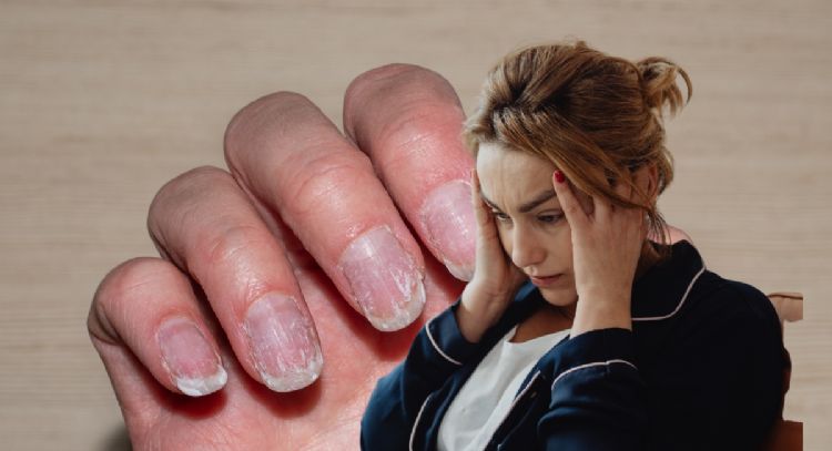 Manicura de gel: la secuela irreversible que descubrió la ciencia y cómo puedes evitarla