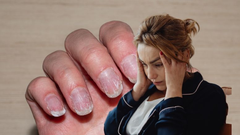Manicura de gel: la secuela irreversible que descubrió la ciencia y cómo puedes evitarla