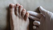 Foto ilustrativa de la nota titulada: Cómo eliminar los hongos en las uñas de los pies