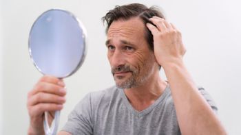 Caída del cabello: ¿cuándo debemos preocuparnos?