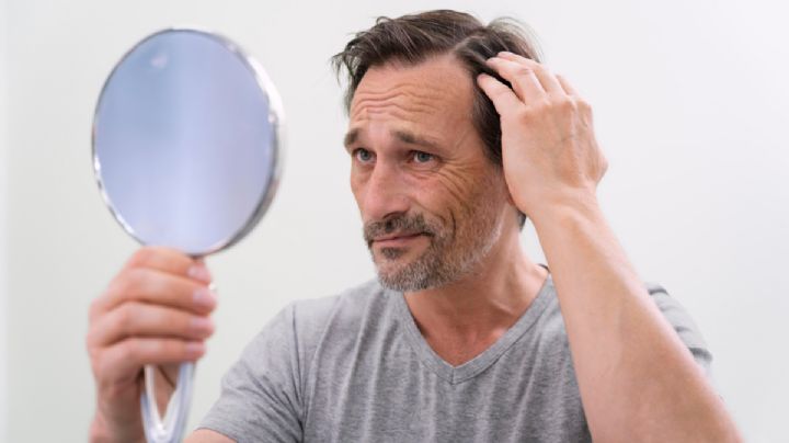 Caída del cabello: ¿cuándo debemos preocuparnos?
